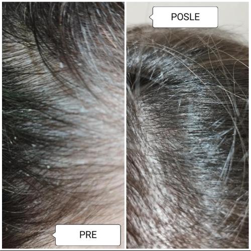 novi Å¡Å¡Å¡amp