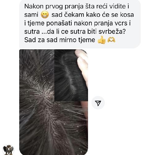 Novi Å¡ampon