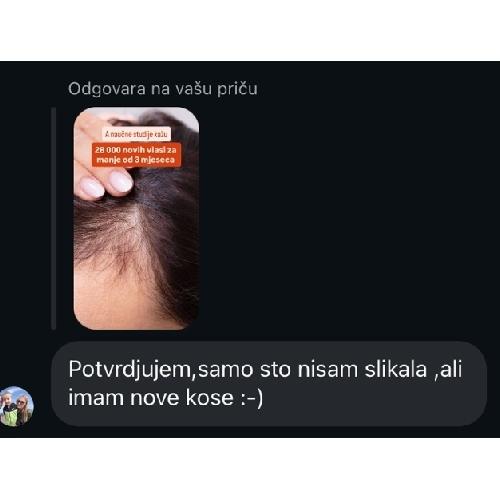 rossen-1001234-baby-hair-rezultati-iskustvo-piskavica-ampula