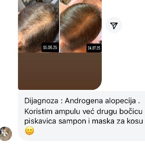 rossen-1001234-androgena-alopecija-oporavak-kose-piskavica-ampula