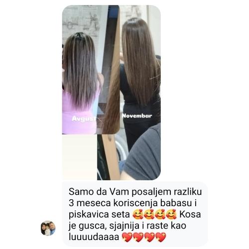 rossen-rezultati-prije-poslije-rast-kose-1001235 jpg