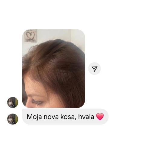 rossen-prikaz-rasta-kose-prije-poslije-1001239 jpg