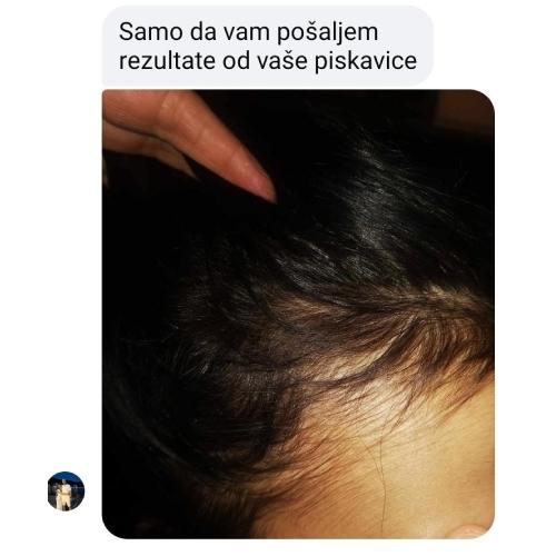 rossen-10012344-popunjavanje-zalistaka-rezultat-piskavica-ampula