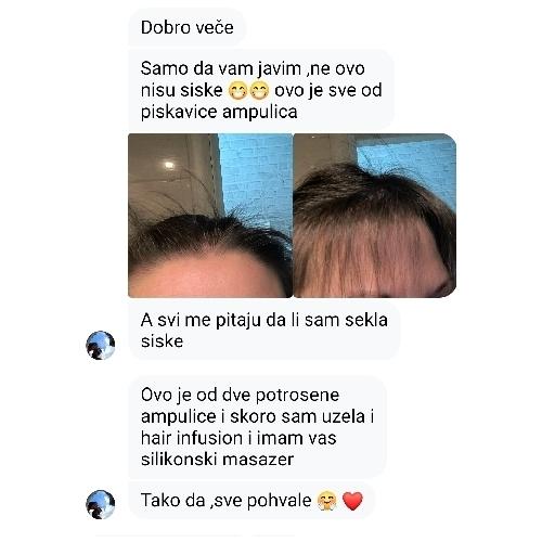 rossen-10012344-primjena-ampule-na-tjeme-piskavica