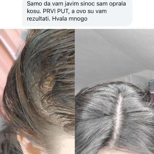 rossen-iskustvo-korisnice-sampon-bez-peruti-1001227 jpg