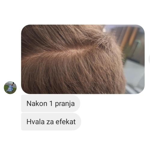 rossen-brzo-umirenje-svraba-vlasista-1001228 jpg
