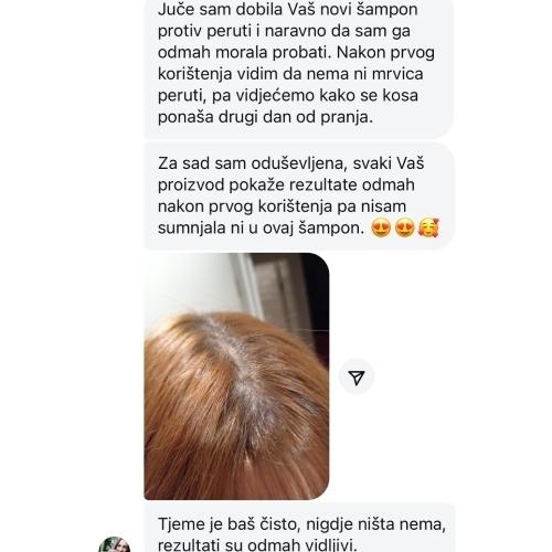 rossen-hidratacija-i-regeneracija-koze-glave-1001228 jpg