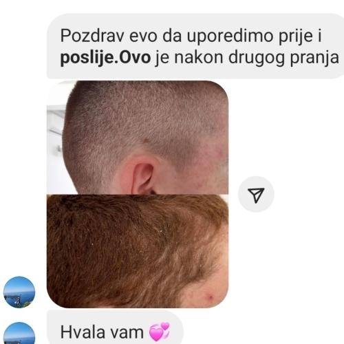 rossen-prikaz-oporavka-tjemena-prije-poslije-1001228 jpg