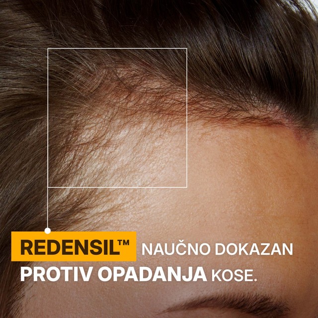 rossen-1001234-protiv-opadanja-kose-rezultat-ampula