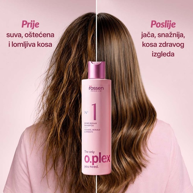 KOSA-PRIJE-I-POSLIJE