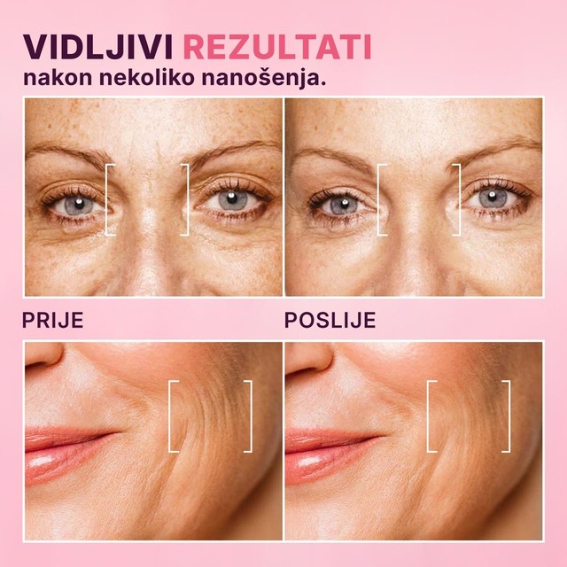 PRIJE-POSLIJE