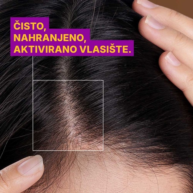 rossen-cisto-i-aktivirano-vlasiste-piskavica-losion-1001235 jpg