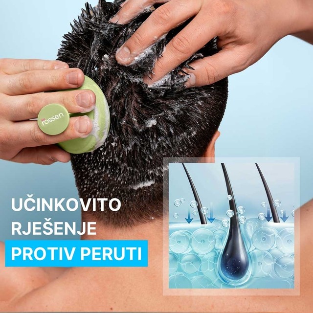 rossen-sampon-protiv-peruti-ucinkovito-rjesenje-protiv-peruti-1001227 jpg